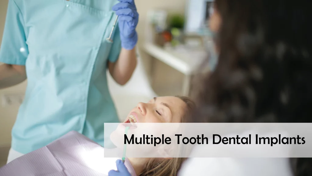 Multiple Tooth Dental Implants